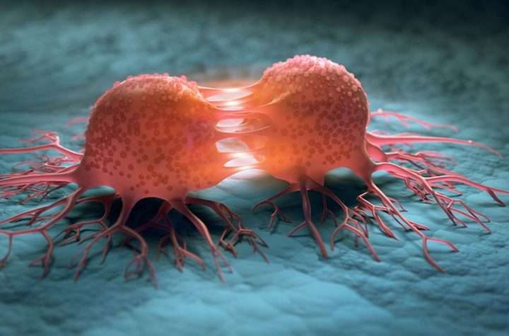 Perbedaan Tumor dan Kanker: Penjelasan Lengkap dan Jenis-Jenisnya